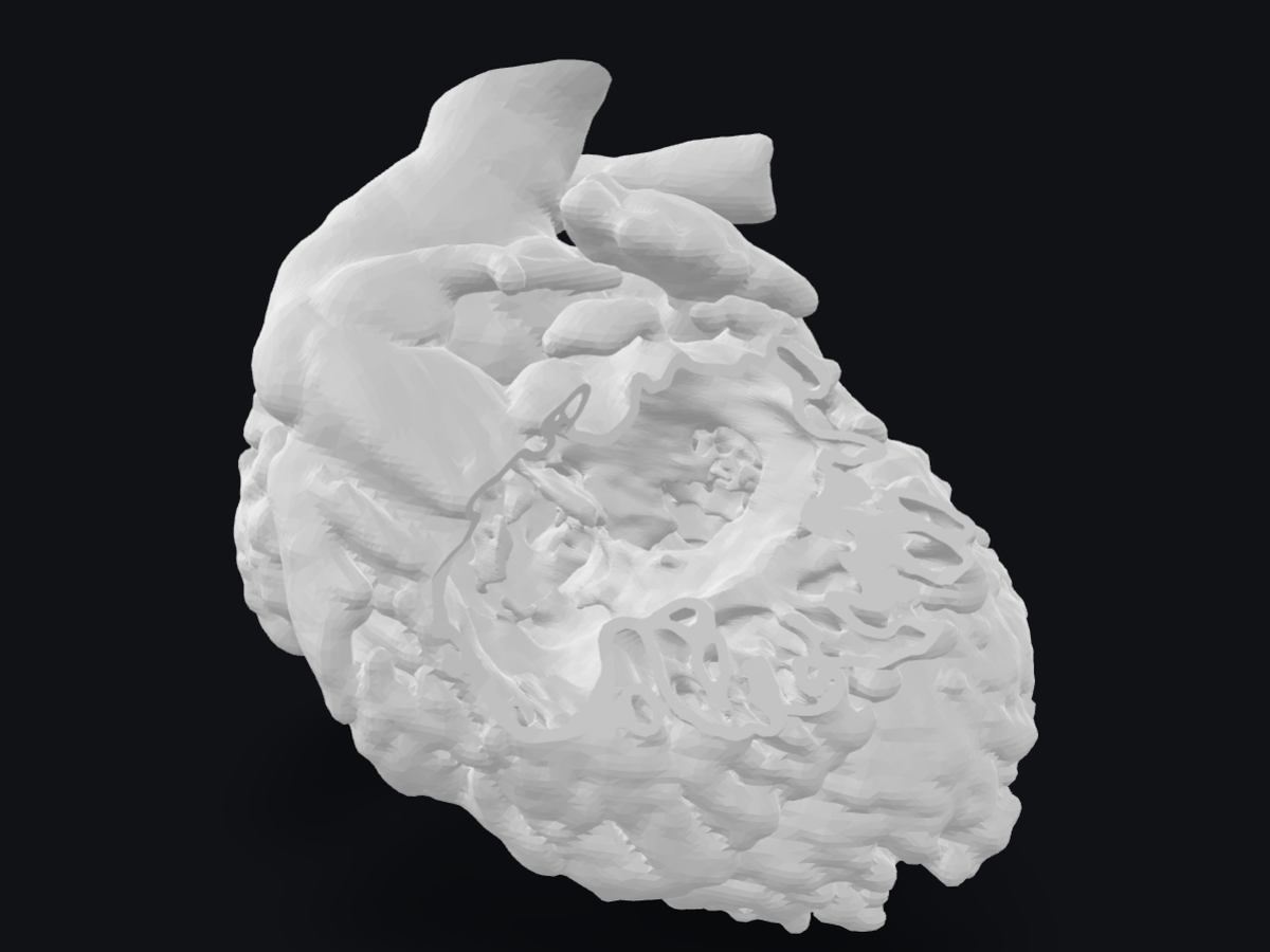 Three-dimensional model of a human heart reconstructed from a CT scan
